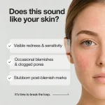 NINELESS A-Control 10% Azelaic Acid Serum - Image 3
