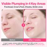Numbuzin No.2 Rose PDRN Collagen Plumping Serum DUO Kit - Image 8