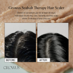 GROWUS Sea Salt Therapy Scalp Scaler - Image 6