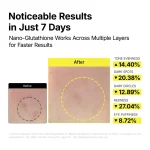 ma:nyo Glutathione 7 Dark Spot Serum Patch - Image 11