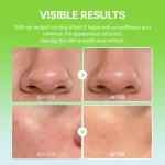 Dr.Melaxin Cactox Pore Relief Multi Balm - Image 6