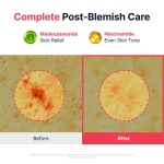 SUNGBOON EDITOR Red Heartleaf BHA-Lino Relief Ampoule - Image 6