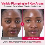 Numbuzin No.2 Rose PDRN Collagen Plumping Serum DUO Kit - Image 9