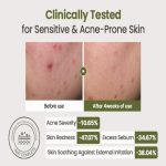 HEVEBLUE Derma Zinc Matcha MX Active Cream - Image 5