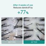 lilyeve Scalp:Turn Cica PDRN Brush Ampoule - Image 6