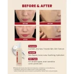 KSECRET SEOUL 1988 Essence : Snail Mucin 97% + Rice - Image 5